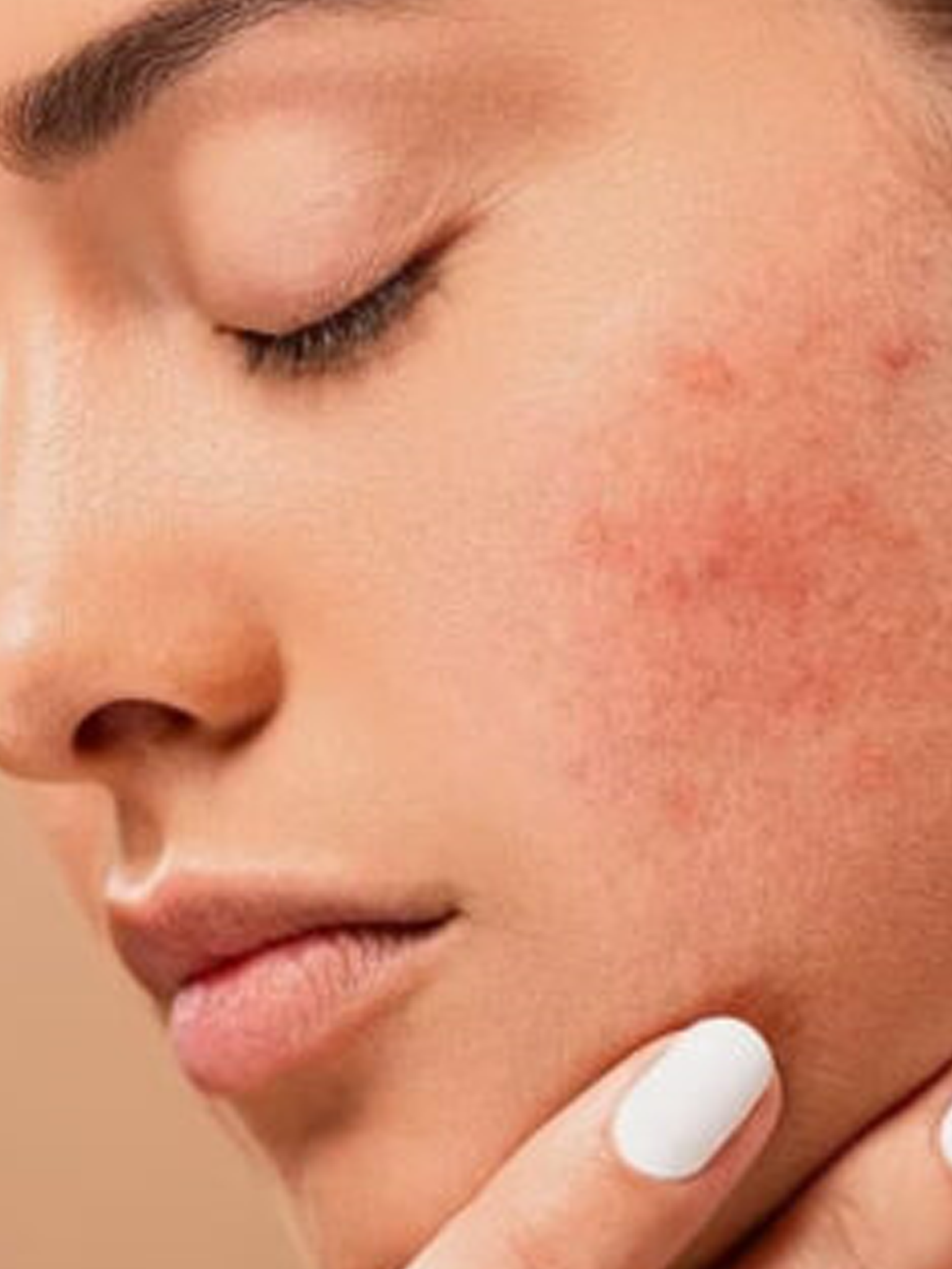 How to prevent clogged pores throughout the summer.