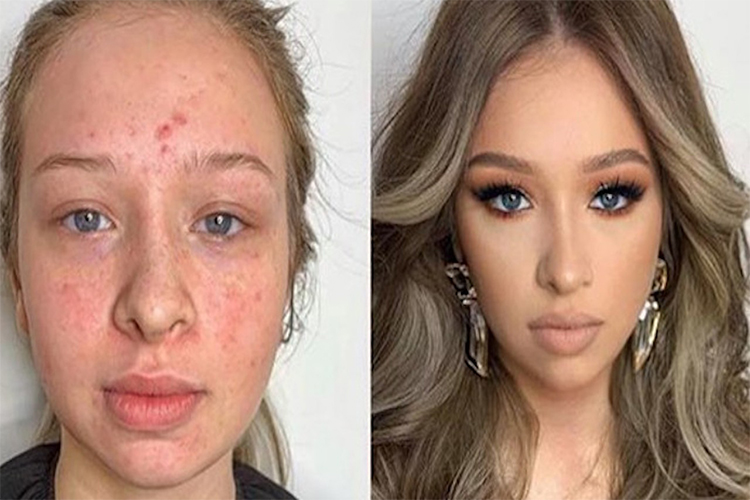 11 Unbelievable Beauty Transformations.