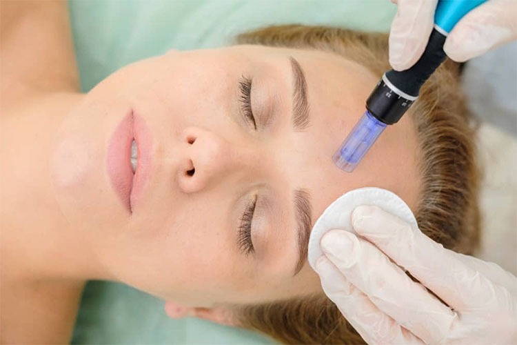 Pros and cons of various skincare treatments.