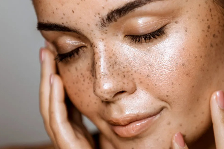 In conclusion, achieving gorgeous skin doesn't have to be complicated or time-consuming. By incorporating these simple steps into your daily routine, you can achieve a glowing, healthy complexion in just minutes a day. Remember to cleanse, exfoliate, moisturize, protect, and hydrate your skin, get enough sleep, eat a healthy diet, and practice self-care. With a little effort and consistency, you can have the beautiful, radiant skin you've always wanted.